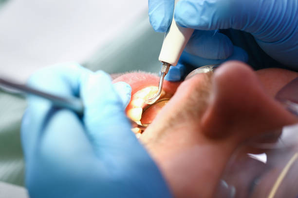 Best Emergency Treatment for Toothache in Clymer, PA